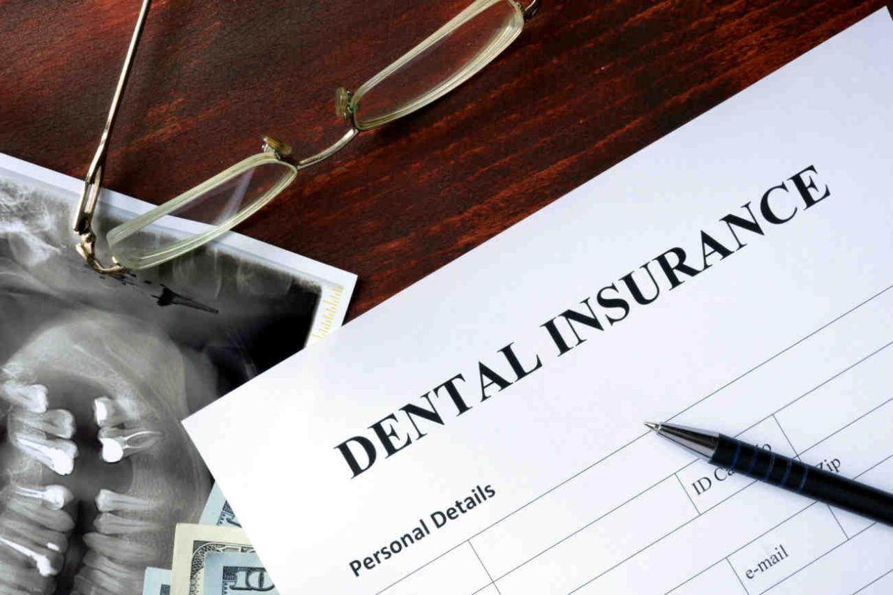 Can health insurance cover dental